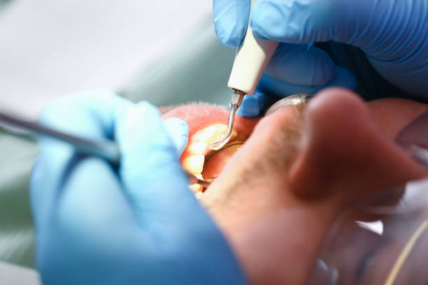 Best Emergency Gum Pain Relief  in Plymouth, MI